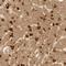 Eukaryotic Translation Initiation Factor 4 Gamma 3 antibody, NBP1-84865, Novus Biologicals, Immunohistochemistry frozen image 