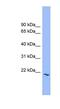 Proline Rich And Gla Domain 2 antibody, NBP1-57017, Novus Biologicals, Western Blot image 