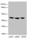 Interleukin 2 Receptor Subunit Gamma antibody, A50310-100, Epigentek, Western Blot image 