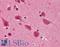 TAR DNA Binding Protein antibody, LS-B4521, Lifespan Biosciences, Immunohistochemistry paraffin image 