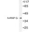 RNA Binding Motif Protein X-Linked antibody, LS-C176907, Lifespan Biosciences, Western Blot image 