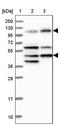 Intraflagellar Transport 122 antibody, PA5-59742, Invitrogen Antibodies, Western Blot image 