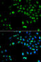 Homeobox A1 antibody, STJ29004, St John