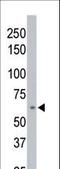 Protein Phosphatase, Mg2+/Mn2+ Dependent 1D antibody, LS-C101018, Lifespan Biosciences, Western Blot image 