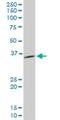 Pyrophosphatase (Inorganic) 1 antibody, H00005464-M01, Novus Biologicals, Western Blot image 