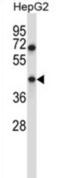 Vacuole Membrane Protein 1 antibody, abx027467, Abbexa, Western Blot image 