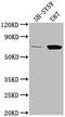 Tumor Protein P73 antibody, CSB-PA024092OA01HU, Cusabio, Western Blot image 