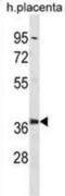 Proteasome 26S Subunit, Non-ATPase 6 antibody, abx031479, Abbexa, Western Blot image 