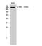 Protein Tyrosine Kinase 2 Beta antibody, A01066Y580-1, Boster Biological Technology, Western Blot image 