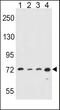 Arachidonate 15-Lipoxygenase antibody, PA5-15065, Invitrogen Antibodies, Western Blot image 