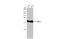 Cofilin 1 antibody, GTX632582, GeneTex, Western Blot image 