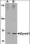 Sprouty Related EVH1 Domain Containing 1 antibody, orb89204, Biorbyt, Western Blot image 