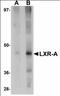 Nuclear Receptor Subfamily 1 Group H Member 3 antibody, orb89853, Biorbyt, Western Blot image 