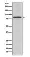 Periostin antibody, M01378, Boster Biological Technology, Western Blot image 
