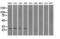 Proteasome Subunit Alpha 7 antibody, GTX83786, GeneTex, Western Blot image 