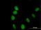 ADP Ribosylation Factor Like GTPase 6 Interacting Protein 4 antibody, H00051329-B01P, Novus Biologicals, Immunocytochemistry image 
