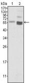 Phosphatase And Tensin Homolog antibody, GTX83304, GeneTex, Western Blot image 