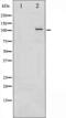 Protein Kinase D1 antibody, abx011357, Abbexa, Western Blot image 