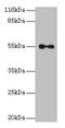 Thyroid Hormone Receptor Alpha antibody, CSB-PA023510LA01HU, Cusabio, Western Blot image 