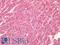 Activin A Receptor Type 1 antibody, LS-A12859, Lifespan Biosciences, Immunohistochemistry paraffin image 