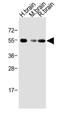 Activin A Receptor Type 1B antibody, MBS9201918, MyBioSource, Western Blot image 