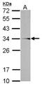 ADP/ATP translocase 3 antibody, NBP2-20394, Novus Biologicals, Western Blot image 