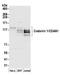 Codanin-1 antibody, A304-952A, Bethyl Labs, Western Blot image 