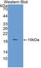 Baculoviral IAP Repeat Containing 2 antibody, LS-C301189, Lifespan Biosciences, Western Blot image 