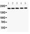 TSC Complex Subunit 2 antibody, PB9121, Boster Biological Technology, Western Blot image 