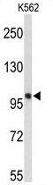 Hsp110 antibody, GTX81974, GeneTex, Western Blot image 