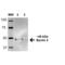 Beclin 2 antibody, SPC-604D, StressMarq, Western Blot image 