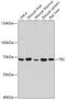 Tyrosine-protein kinase Tec antibody, GTX64753, GeneTex, Western Blot image 