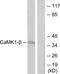 Pregnancy Up-Regulated Nonubiquitous CaM Kinase antibody, GTX88001, GeneTex, Western Blot image 
