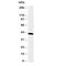 Hydroxysteroid 17-Beta Dehydrogenase 2 antibody, R30684, NSJ Bioreagents, Western Blot image 