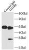 Thiamine Triphosphatase antibody, FNab08678, FineTest, Immunoprecipitation image 