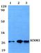 Sodium Channel Modifier 1 antibody, A10999, Boster Biological Technology, Western Blot image 