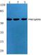 P21 (RAC1) Activated Kinase 2 antibody, A01419S20, Boster Biological Technology, Western Blot image 