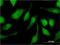 Tripartite Motif Containing 47 antibody, H00091107-M02, Novus Biologicals, Immunofluorescence image 
