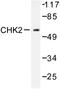 Serine/threonine-protein kinase Chk2 antibody, AP06512PU-N, Origene, Western Blot image 