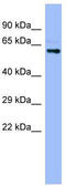 Cytochrome P450 Family 4 Subfamily A Member 22 antibody, TA346248, Origene, Western Blot image 