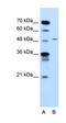 Tyrosinase Related Protein 1 antibody, orb325135, Biorbyt, Western Blot image 