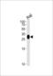 Major Histocompatibility Complex, Class II, DR Beta 4 antibody, LS-C164921, Lifespan Biosciences, Western Blot image 
