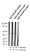 Adrenoceptor Beta 2 antibody, GTX02869, GeneTex, Western Blot image 