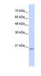 Prefoldin Subunit 6 antibody, NBP1-56417, Novus Biologicals, Western Blot image 