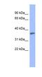 Protein Kinase C Gamma antibody, NBP1-58917, Novus Biologicals, Western Blot image 