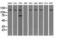 Transient Receptor Potential Cation Channel Subfamily M Member 4 antibody, M02130, Boster Biological Technology, Western Blot image 