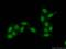 DIS3 Homolog, Exosome Endoribonuclease And 3'-5' Exoribonuclease antibody, 14689-1-AP, Proteintech Group, Immunofluorescence image 
