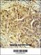 Cell Division Cycle 45 antibody, 64-163, ProSci, Immunohistochemistry paraffin image 