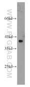 Zinc Finger Protein 24 antibody, 11219-1-AP, Proteintech Group, Western Blot image 