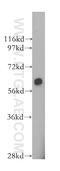 Protein Kinase AMP-Activated Catalytic Subunit Alpha 1 antibody, 10929-2-AP, Proteintech Group, Western Blot image 
